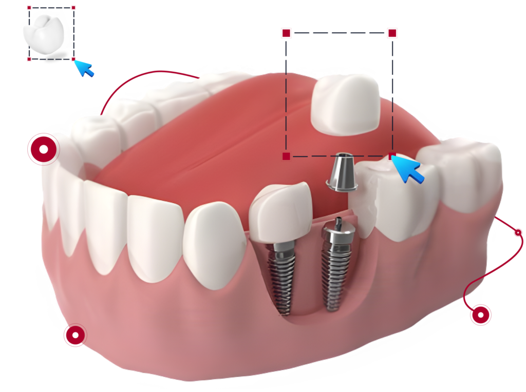 dentalu3D